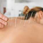 Acupuncture-as-an-Alternative-to-Opioids