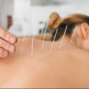 Acupuncture-as-an-Alternative-to-Opioids
